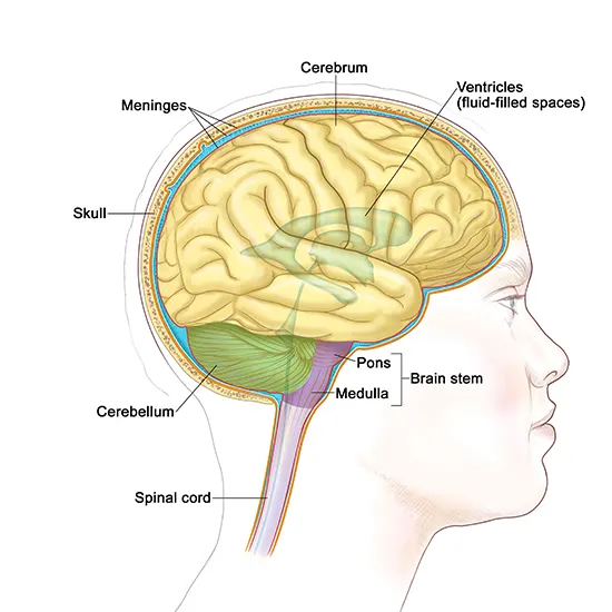Brainstem Glioma: An overview, Causes, Types and Treatment